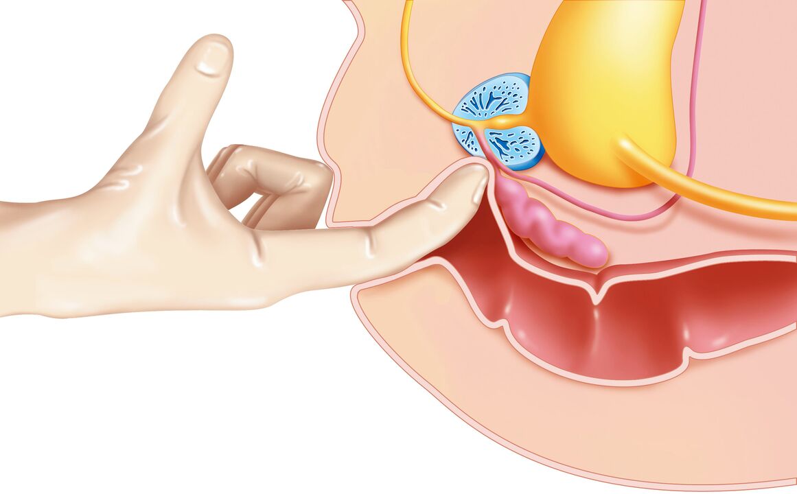 Stimulation of the G spot in men